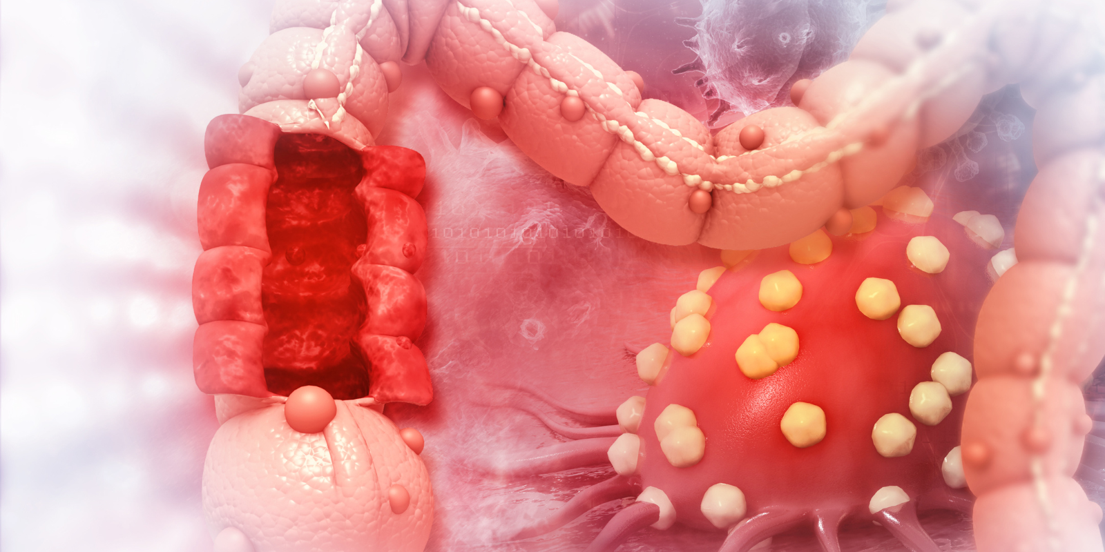 Digestive System Cancers and Diseases