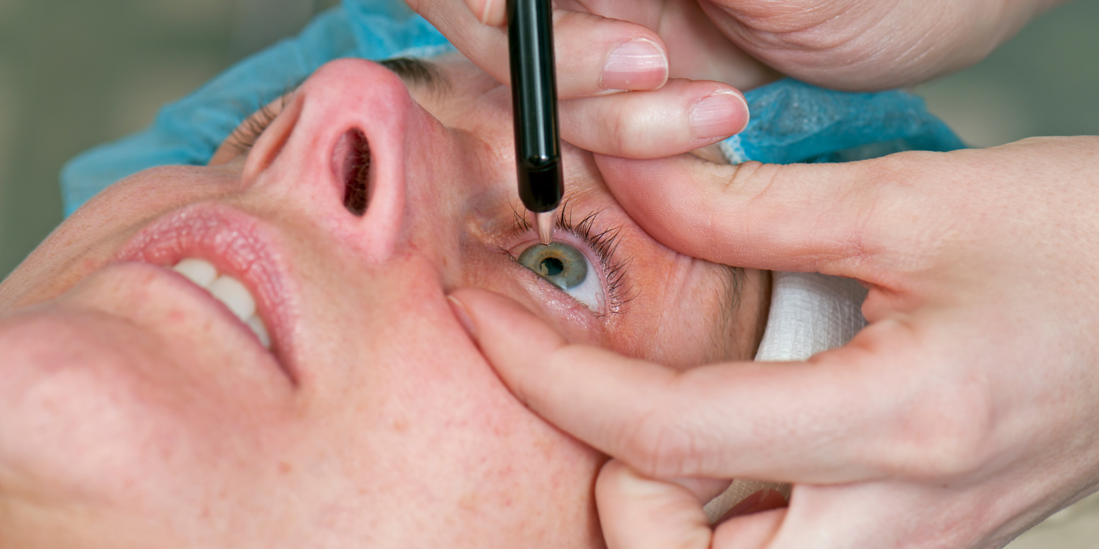 Lasik Eye Surgery (non touch laser)