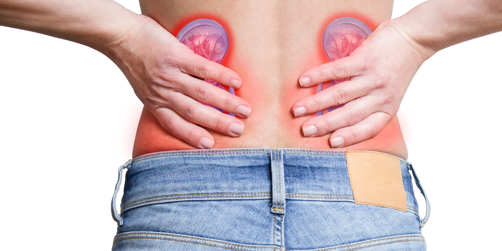 Urolithiasis