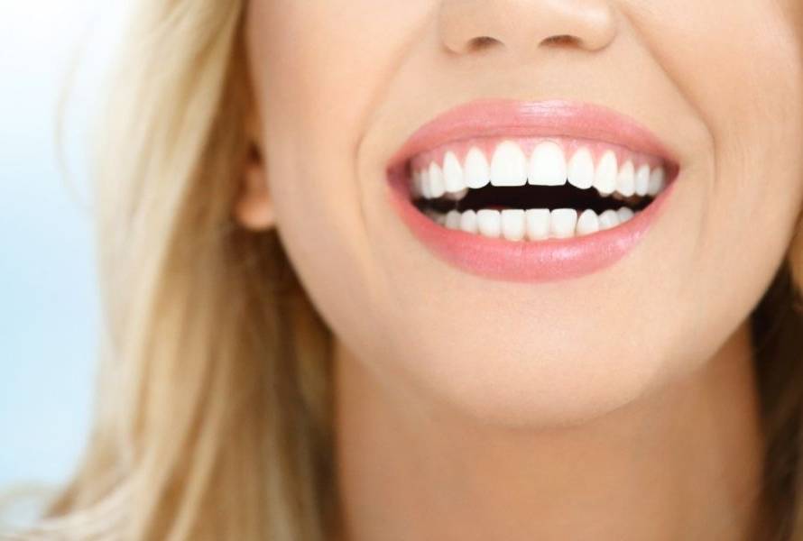 dental ımplants
